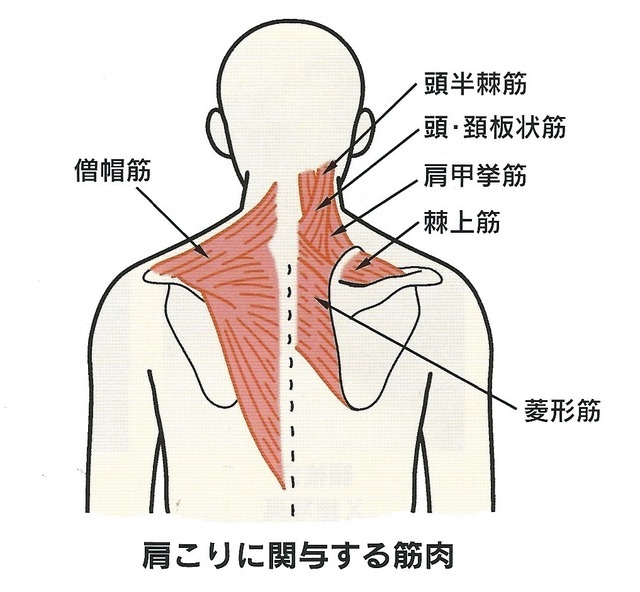 根本原因の特定方法