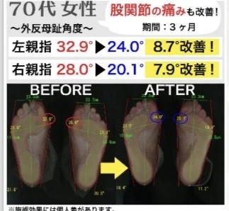 ダウンロード