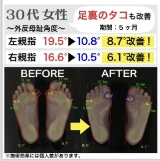 ダウンロード